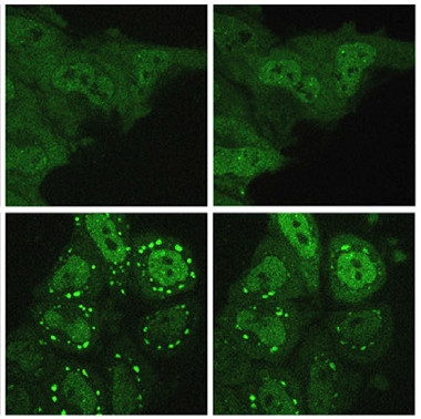 Newest ALS FTD Gene Keeps Spotlight on Stress Granules 