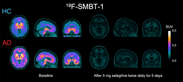 https://www.alzforum.org/sites/default/files/styles/media_large/public/03.25_SMBT-1_Selegiline.jpg?itok=UzZjLtGT